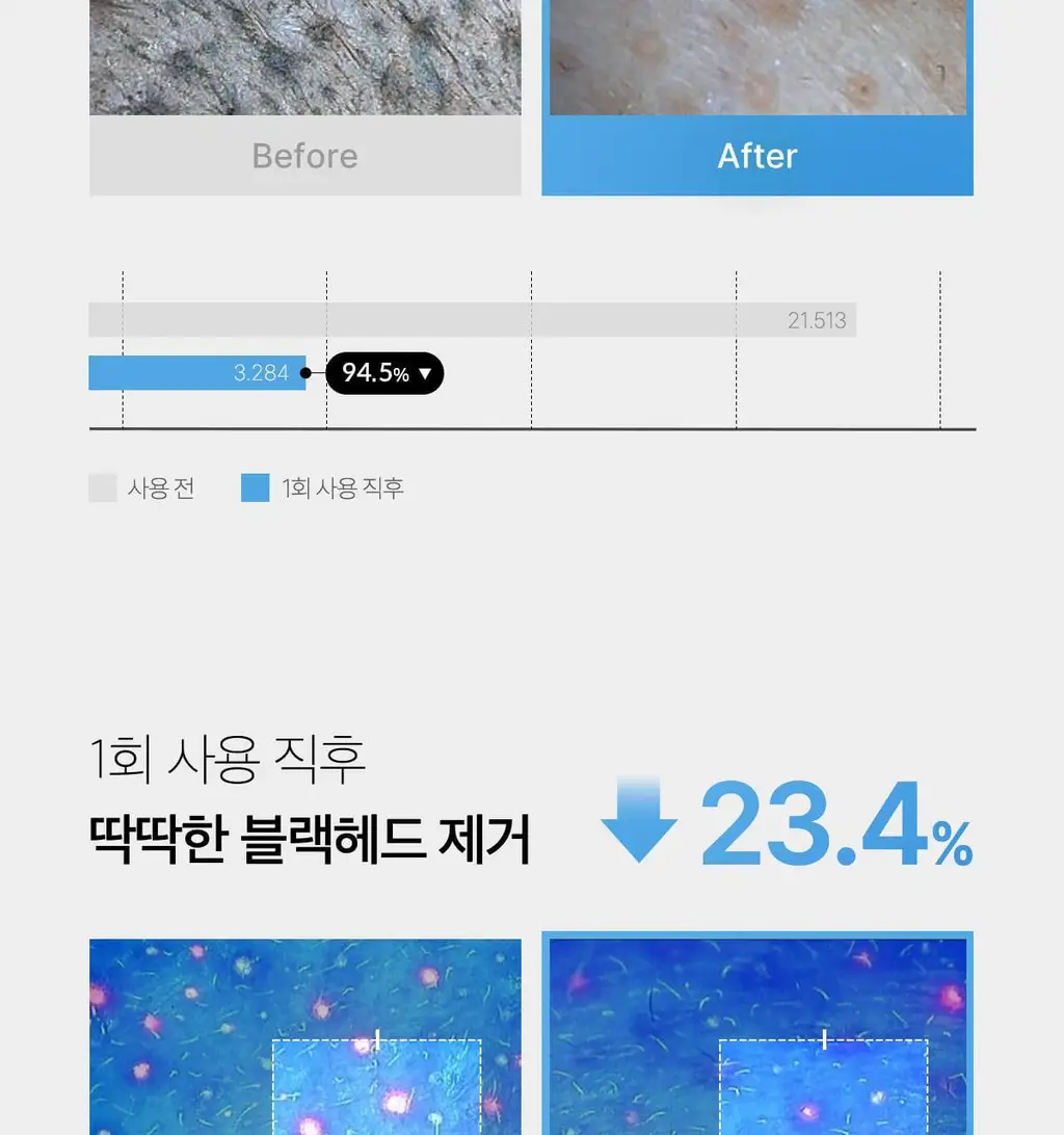 [블랙헤드 제거] 메디큐브 제로 모공 블랙헤드 딥 클렌징오일 205ml 상세페이지 21